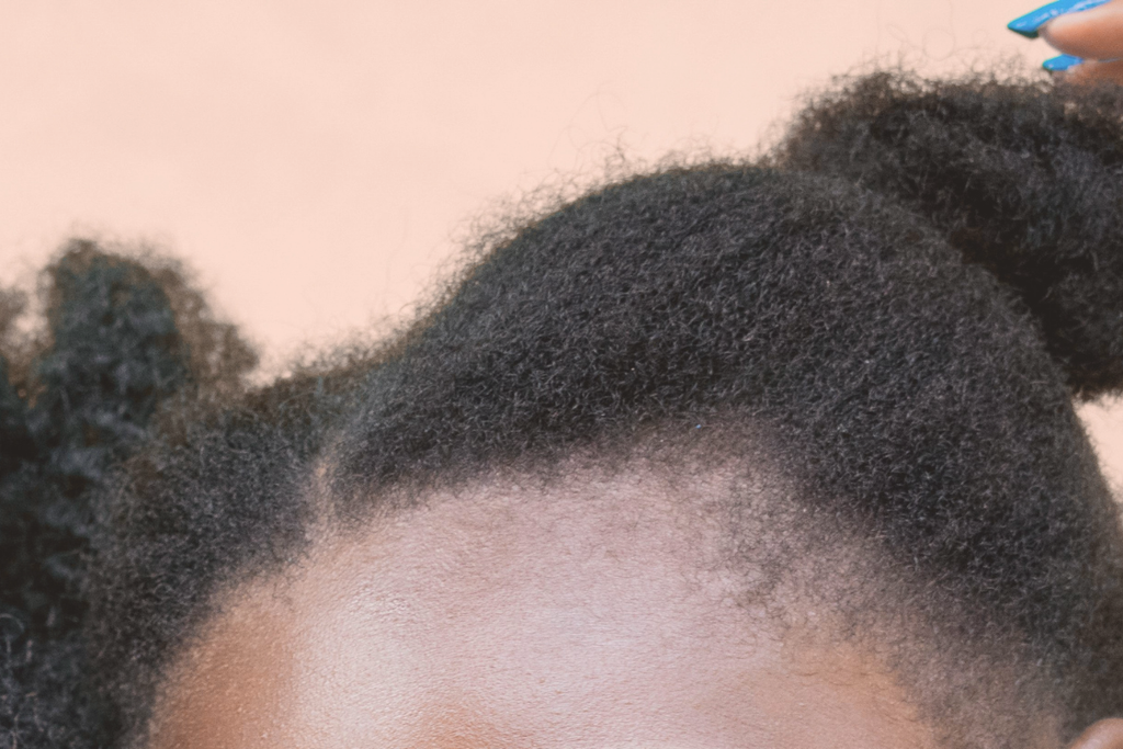 Primo piano dell’attaccatura dei capelli afro con capelli più corti visibili lungo la linea frontale
